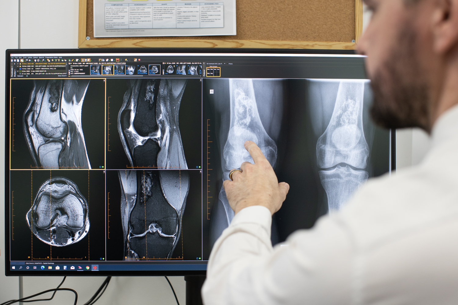 A radiologist at IOP pointing at computer screen with knee MRI scan displayed.